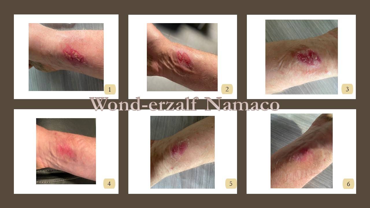 Behandeling met Wond-erzalf Namaco
