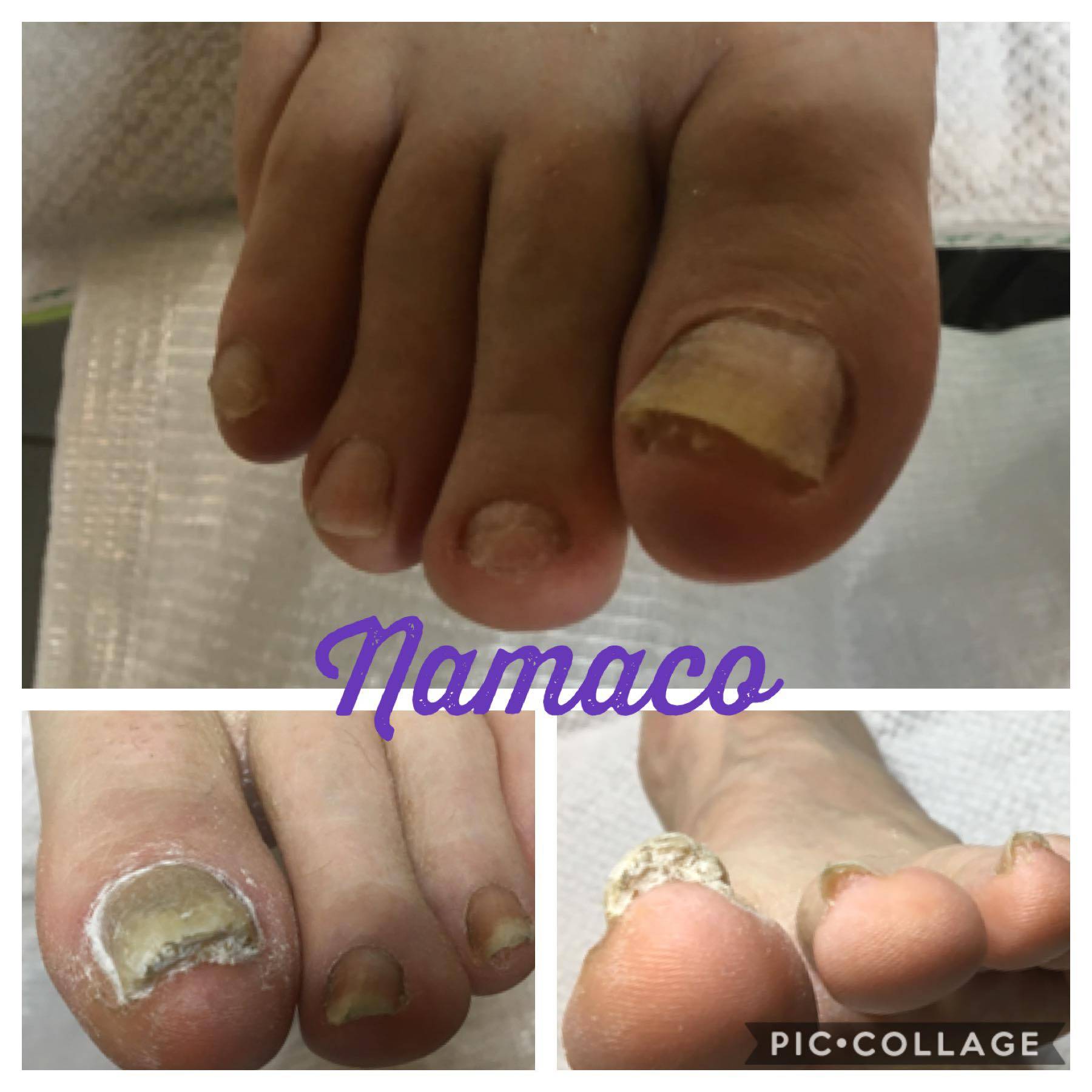 Ook dit is het werk van de pedicure